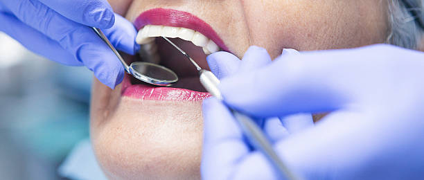 Best Walk-In Dentist Near Me  in Loyola, CA